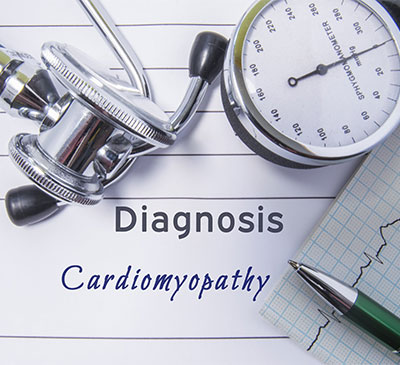 Global Cardiomyopathy Therapies Market 2019-2023